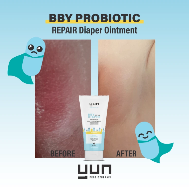 BBY product